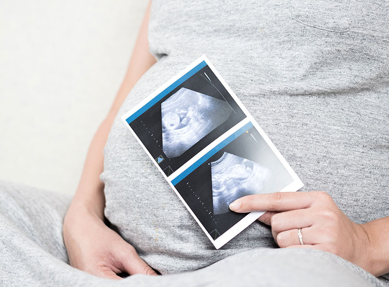 Pregnant woman holding an ultrasound photo